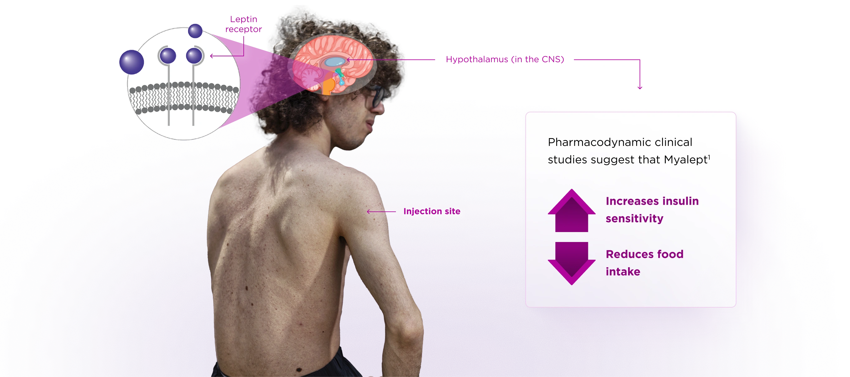 Educational medical graphic showing the mechanism of action and injection sites for Myalept. On the left, a magnified view of leptin receptors is connected to an illustration of the hypothalamus in the brain, labeled 'Hypothalamus (in the CNS)'. A person is shown from the side with a purple arrow pointing to the upper arm labeled 'Injection site'. A callout box states that pharmacodynamic clinical studies suggest Myalept increases insulin sensitivity and reduces food intake