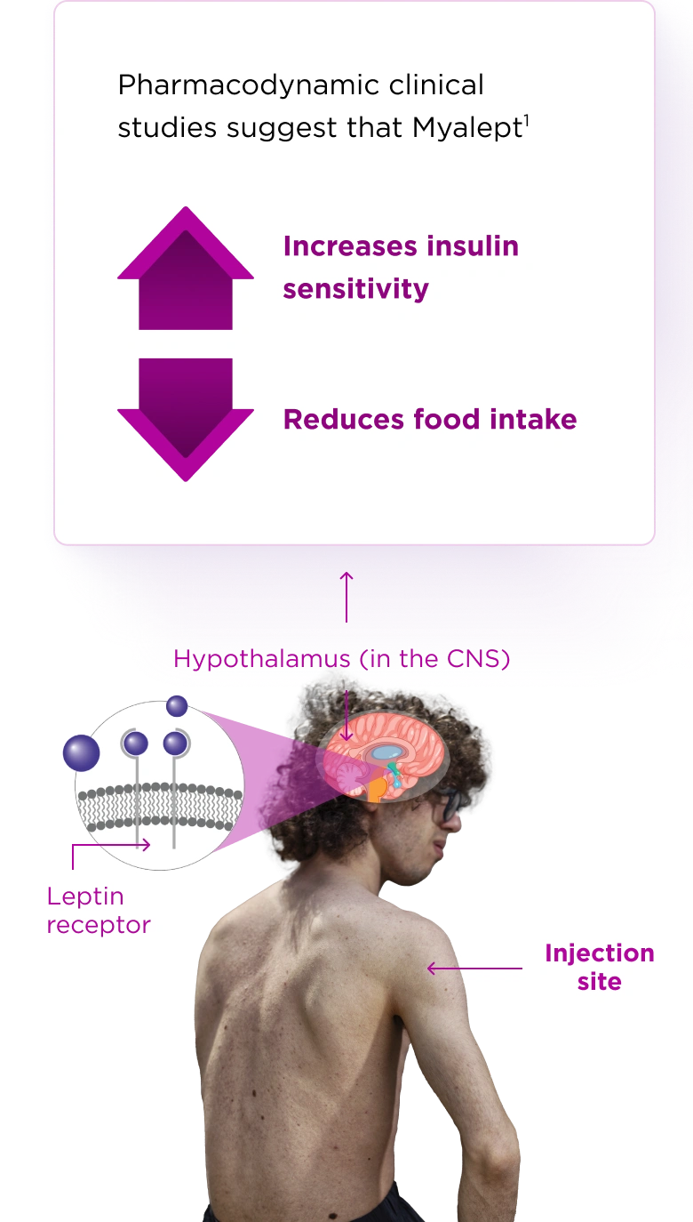 Educational medical graphic showing the mechanism of action and injection sites for Myalept. On the left, a magnified view of leptin receptors is connected to an illustration of the hypothalamus in the brain, labeled 'Hypothalamus (in the CNS)'. A person is shown from the side with a purple arrow pointing to the upper arm labeled 'Injection site'. A callout box states that pharmacodynamic clinical studies suggest Myalept increases insulin sensitivity and reduces food intake